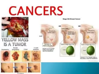 cancers