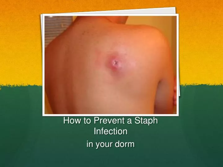 how to prevent a staph infection