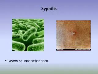 Syphilis