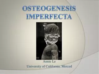 Osteogenesis Imperfecta