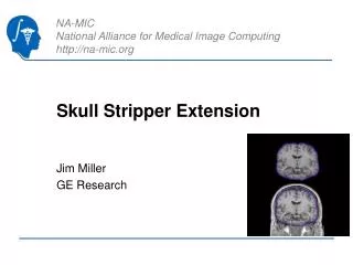 Skull Stripper Extension