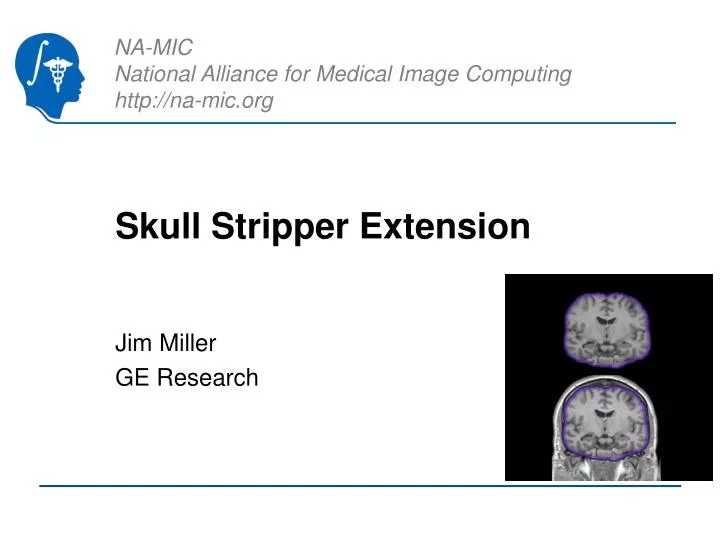 skull stripper extension