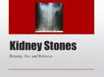 Kidney Stones - slide 1