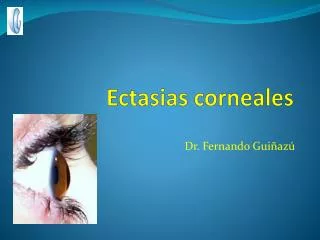 ectasias corneales