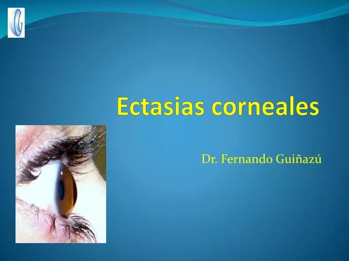 ectasias corneales