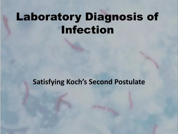 laboratory diagnosis of infection