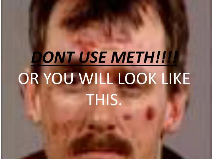 dont use meth or you will look like this