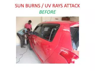 SUN BURNS / UV RAYS ATTACK BEFORE