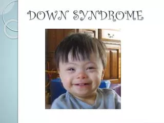 DOWN SYNDROME