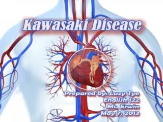 What is Kawasaki Disease?