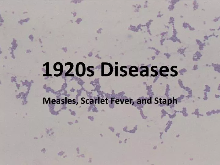 1920s diseases