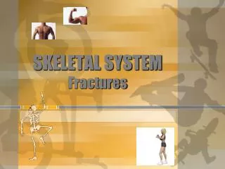 SKELETAL SYSTEM Fractures