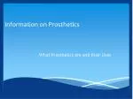 Information on Prosthetics - slide 1