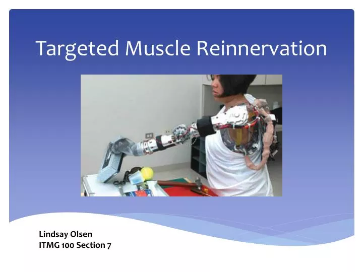 targeted muscle reinnervation