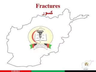 fractures