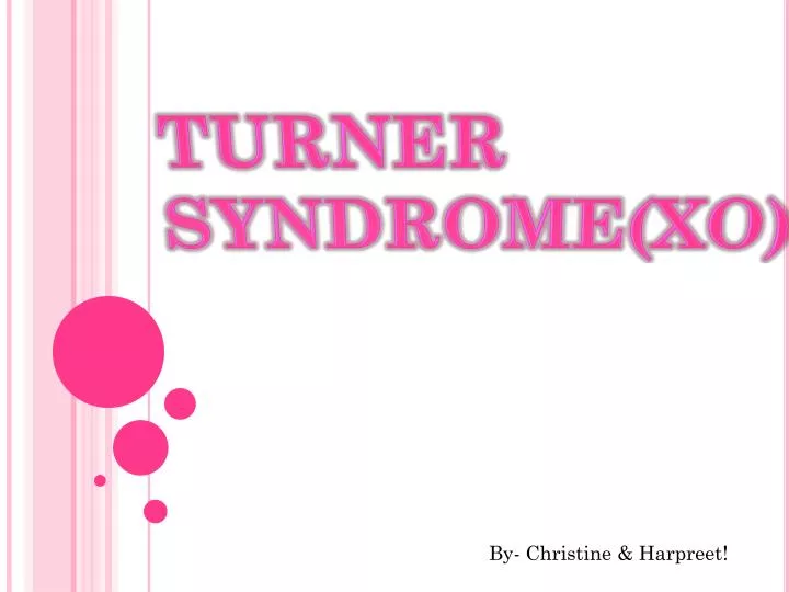 turner syndrome xo