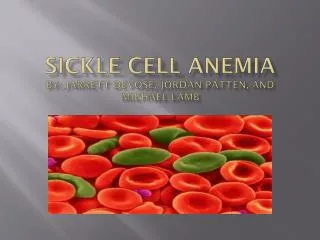 Sickle Cell Anemia By: Jarrett Devose , Jordan Patten, and Michael Lamb