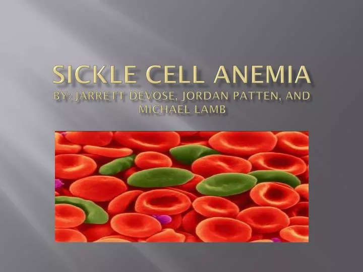 sickle cell anemia by jarrett devose jordan patten and michael lamb