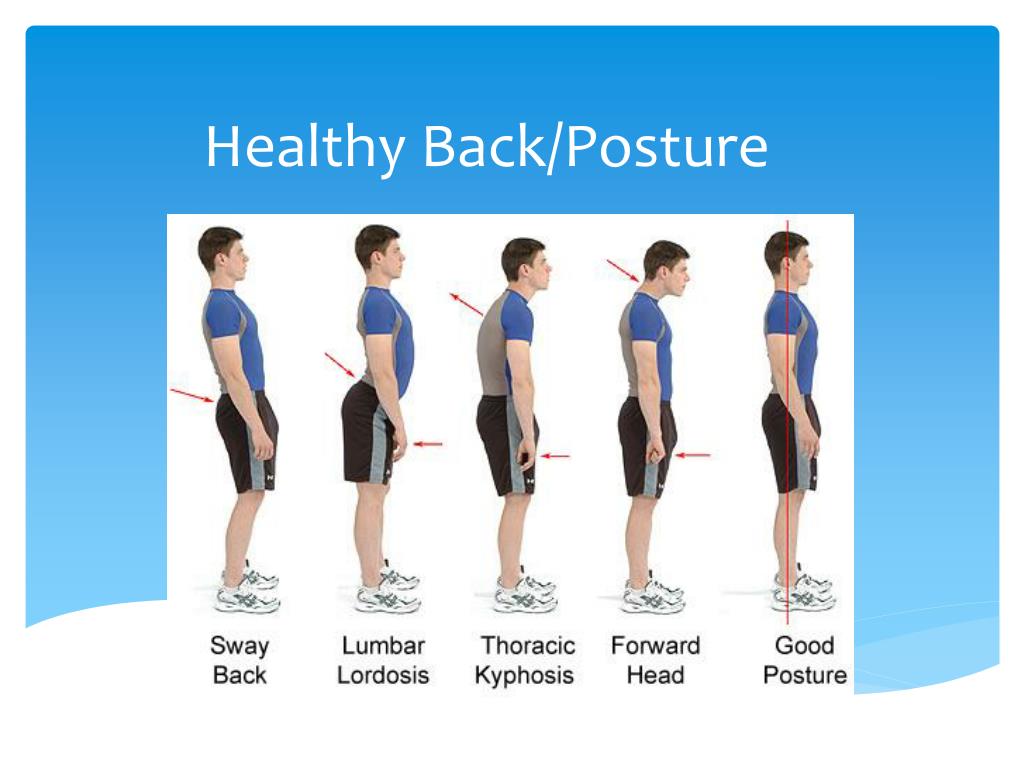 PPT - Healthy Back/Posture PowerPoint Presentation, free download - ID ...