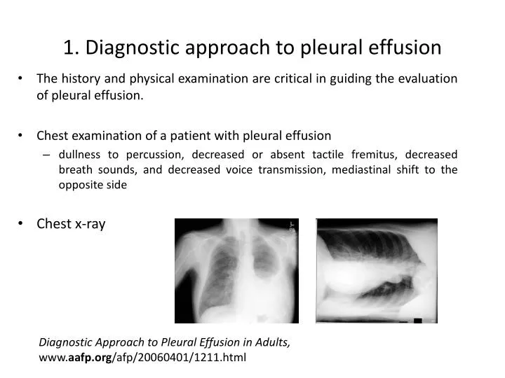 1 diagnostic approach to pleural effusion