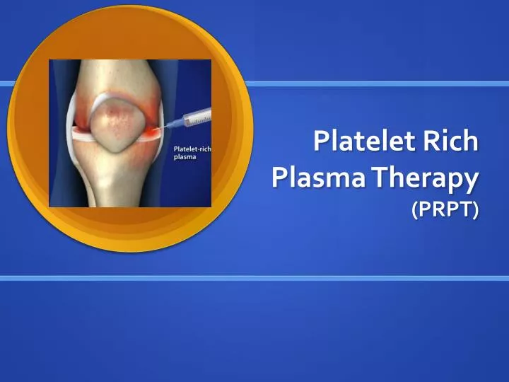 platelet rich plasma therapy prpt