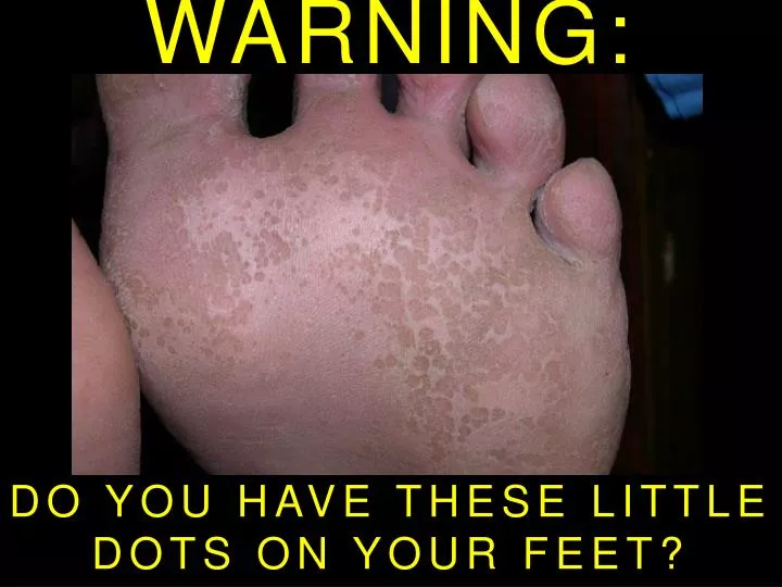 warning do you have these little dots on your feet