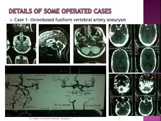 Details of some operated cases