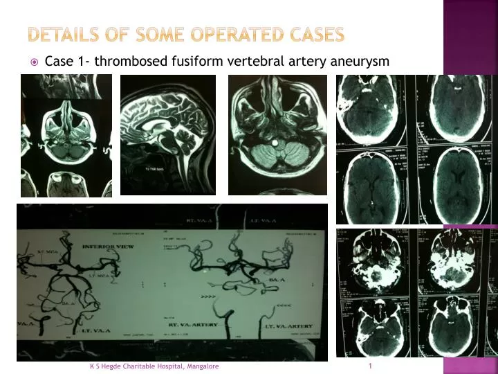 details of some operated cases