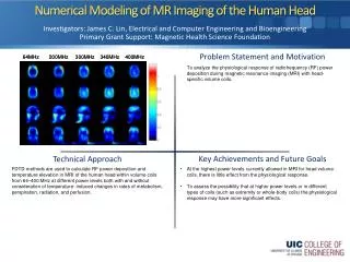 Numerical Modeling of MR Imaging of the Human Head