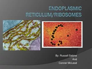 E ndoplasmic reticulum/ribosomes