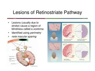 Lesions of Retinostriate Pathway