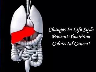 Changes In Life Style Prevent You From Colorectal Cancer!