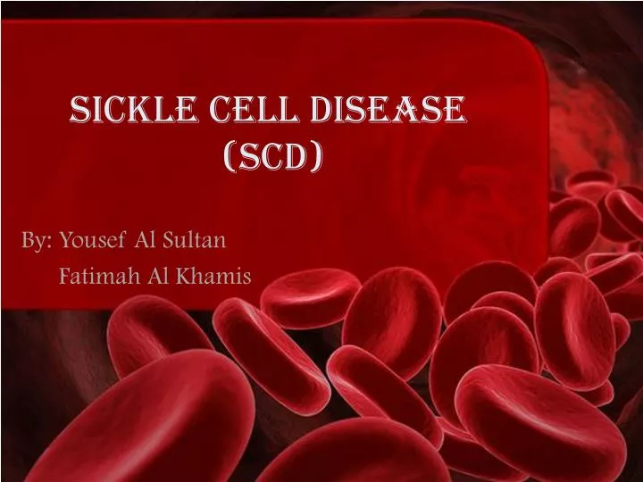 sickle cell disease scd