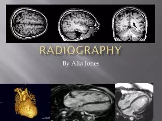 RadioGraphy