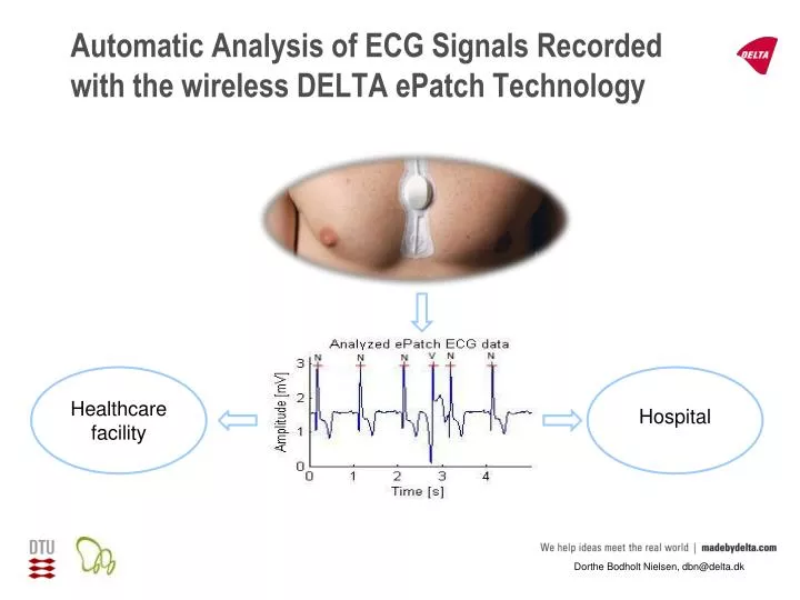 automatic analysis of ecg signals recorded with the wireless delta epatch technology
