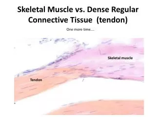 Skeletal Muscle vs. Dense Regular Connective Tissue (tendon)