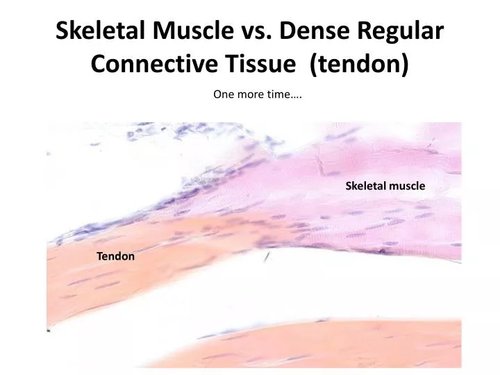 skeletal muscle vs dense regular connective tissue tendon