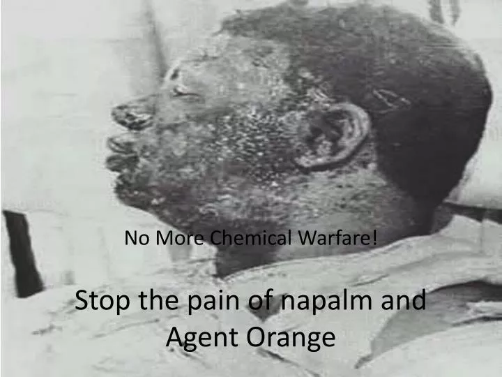 stop the pain of napalm and agent orange
