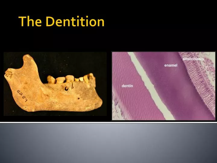 the dentition
