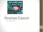 Ovarian Cancer - slide 1