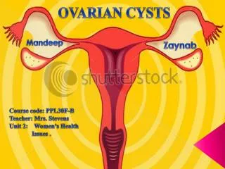 OVARIAN CYSTS