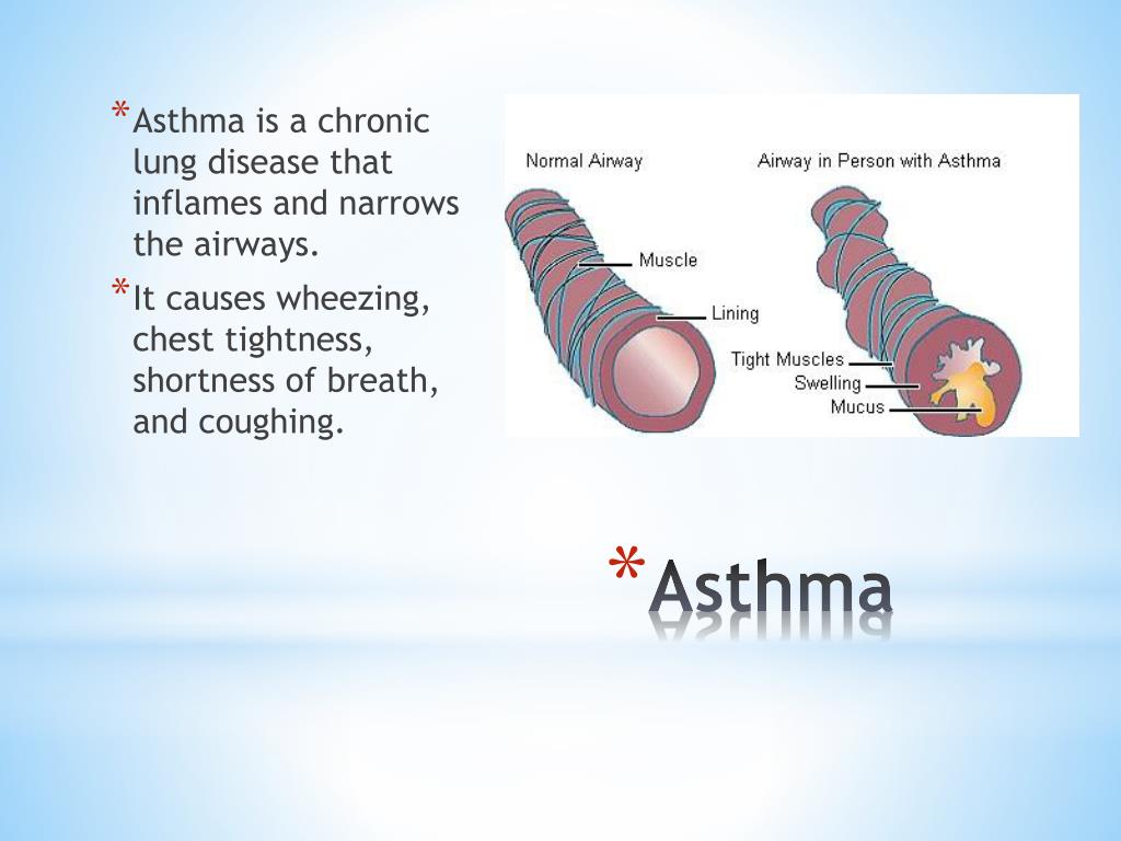 PPT - Asthma PowerPoint Presentation, free download - ID:2668156