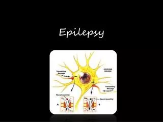 epilepsy