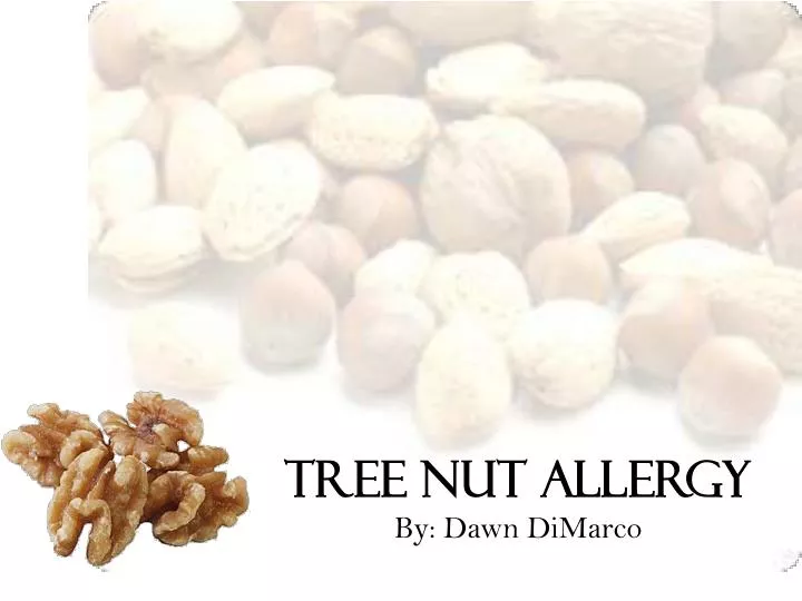 tree nut allergy by dawn dimarco