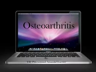 Osteoarthritis