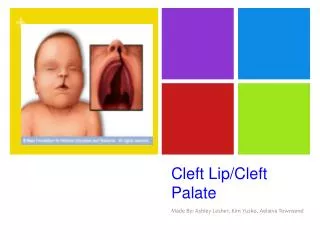 Cleft Lip/Cleft Palate