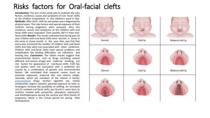 risks factors for oral facial clefts