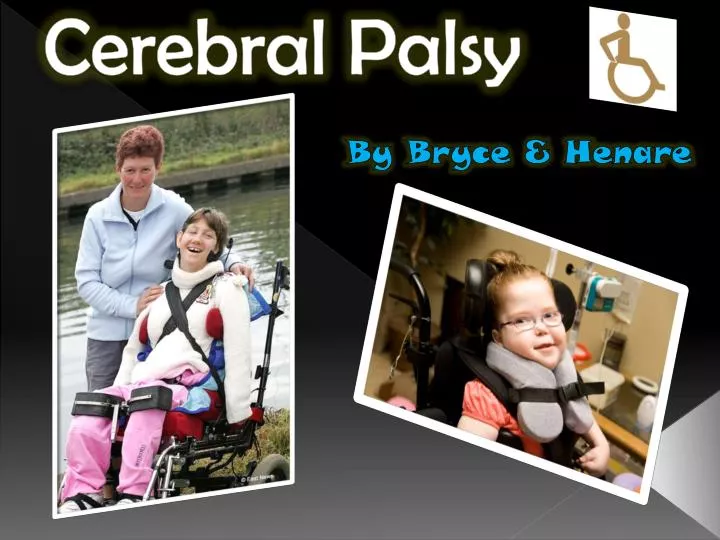 cerebral palsy