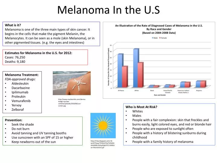melanoma in the u s