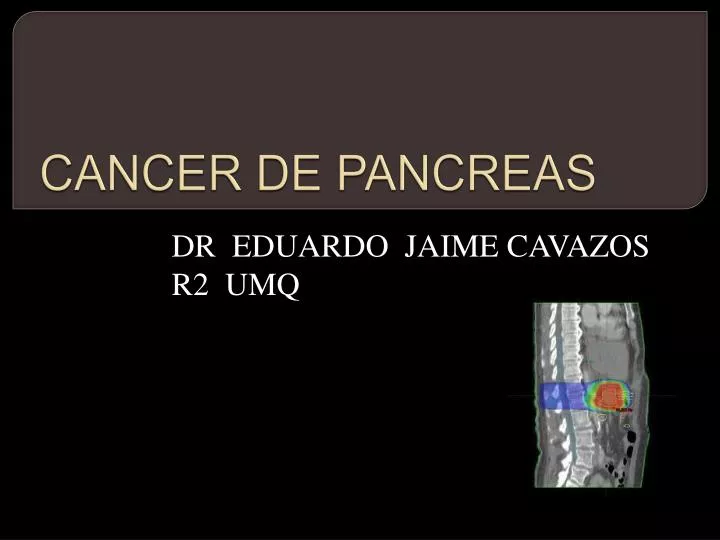 cancer de pancreas